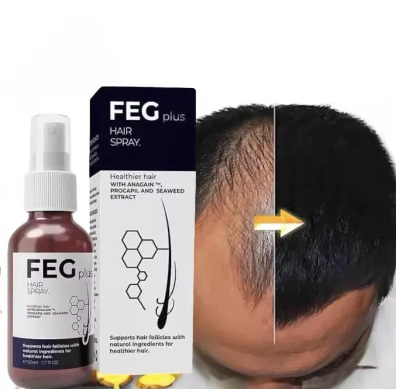 FEG PLUS Hair & Beard Regrowth Spray – Anti Hair Loss Formula with Minoxidil